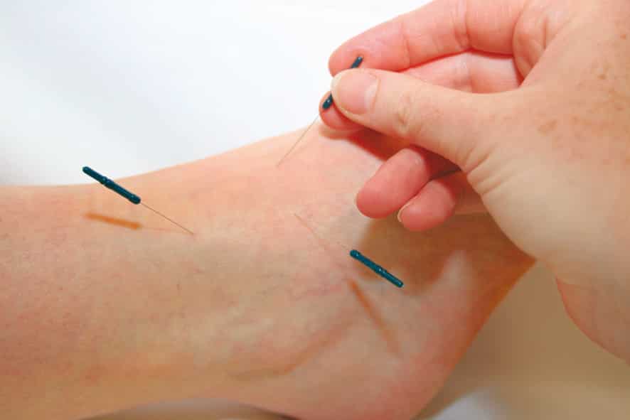 Akupunktur Fuß
